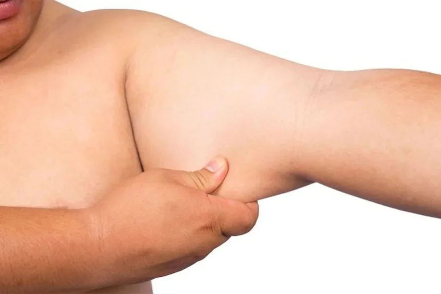 Arm Fat